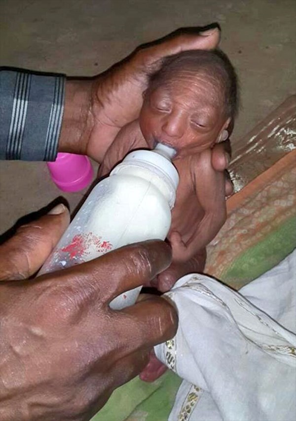 老人のような姿で生まれた赤ちゃん　両親に捨てられるも祖父がヤギの乳で助ける