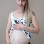 医師も困惑！　出産後17カ月も経っているのに、お腹が妊娠時のままの女性！！