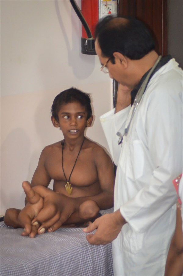 巨大な手により、学校へ行くことを拒否されたインドの少年　ついに手術へ！