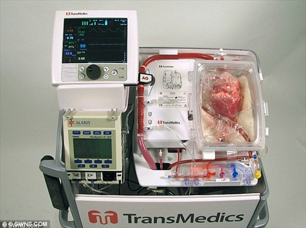心臓を鼓動させたまま移植患者の元へ！　最新移植方法で第一号患者の手術成功！