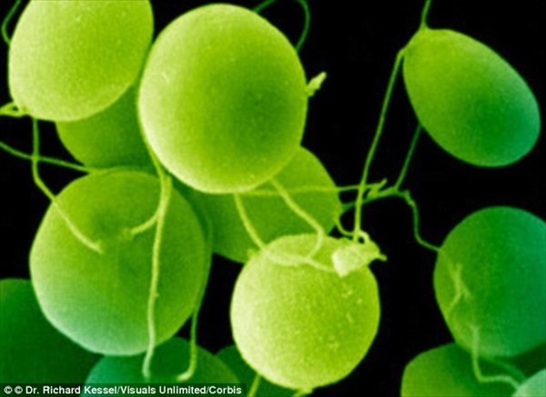 藻で失明が治る！？　藻の光感受性タンパク質を移植する臨床試験、年内実施予定