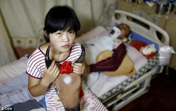 心が痛む…　病気の父と兄弟のため、牛のマスクをかぶり物乞いをする中国の少女