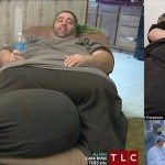 重量36キロの陰嚢を持つ男　14時間に渡る手術の末、7年ぶりに妻とベッドへ