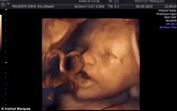 赤ちゃんは妊娠16週から音楽を聴く!?　膣内スピーカーによる実験で明らかに