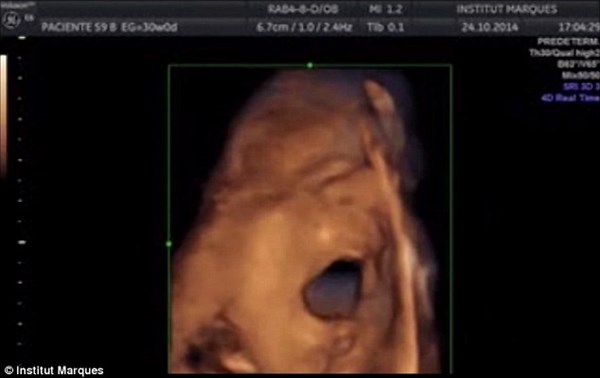赤ちゃんは妊娠16週から音楽を聴く!?　膣内スピーカーによる実験で明らかに