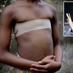 少女の胸に焼けた石を押し付ける「乳房アイロン」というカメルーンの儀式