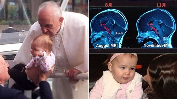 神からの贈り物？　ローマ教皇がキスをした脳腫瘍の女の子、なんと腫瘍が縮小！