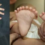 【母も多指症】15本の指と16本の足の指を持つ中国の赤ちゃん、除去手術へ